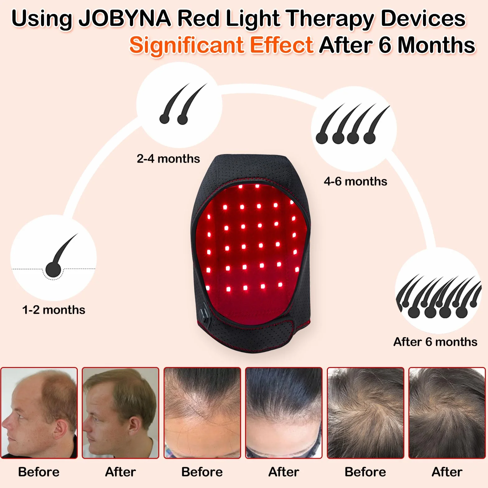 JOBYNA Terapia de luz Roja e Infrarroja Crecimiento Cabello 460nm 660nm 850nm
