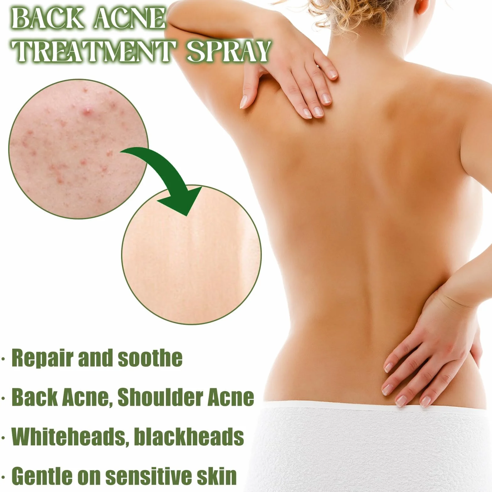 Spray De Tratamiento De Acné 2 PCS, Spray reparador del acné de espalda, Crema Acne Pecho y Espalda
