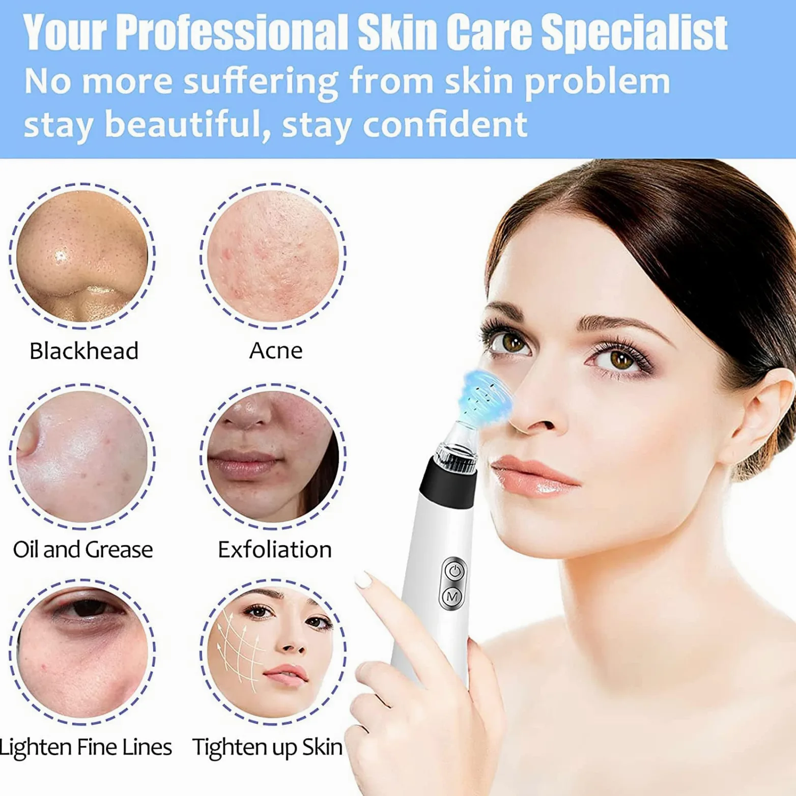 Limpiador facial de poros, limpiador eléctrico de poros, herramienta de succión de puntos negros, herramienta de extracción de puntos blancos, extractor de espinillas de limpieza facial, removedor de
