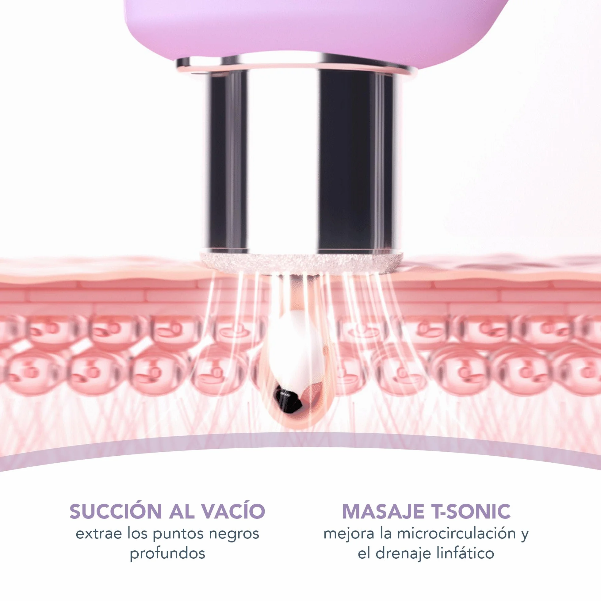 FOREO KIWI Derma Dispositivo de Microdermoabrasión Succionador Extractor Puntos Negros Mascarilla Activa Poros 100g