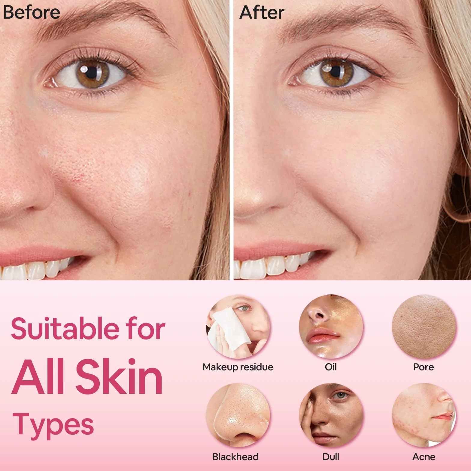 SUNMAY Limpiador Facial Sónico con Iones Positivos y Negativos para Todo Tipo de Piel