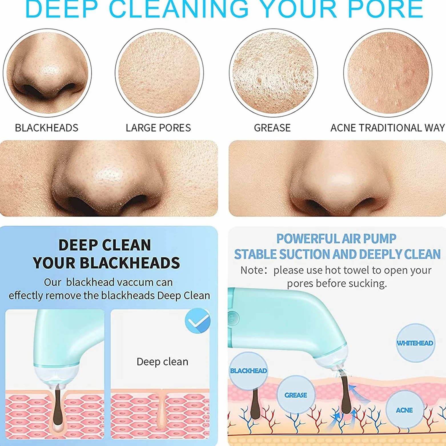 WolFum Limpiador facial de poros: extractor de espinillas de limpieza facial, herramienta de succión de puntos negros, aspiradora de poros para eliminar puntos negros, herramienta extractora de puntos