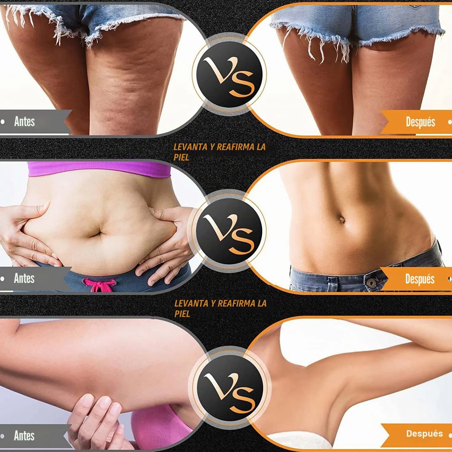 Elitzia Máquina facial de radiofrecuencia RF y EMS, uso doméstico, máquina de estiramiento de la piel, 3 tamaños, reemplazo de cabeza, levantamiento facial, reducción de arrugas, rejuvenecimiento de