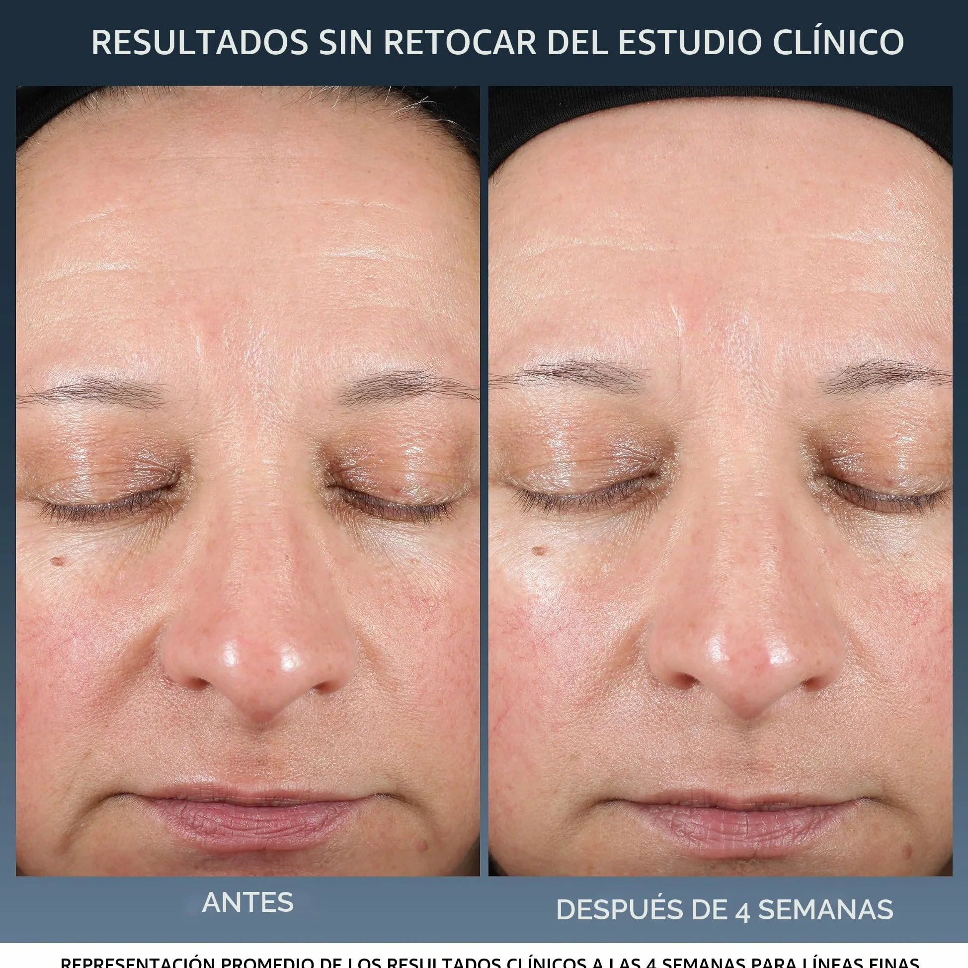 Lancôme - Advanced Génifique - Crema de Noche Reparadora - Hidratante y Antiedad - Tratamiento Facial Antiarrugas - Pre y Probióticos, Triple Ceramidas, Ácido Hialurónico - 50 ml