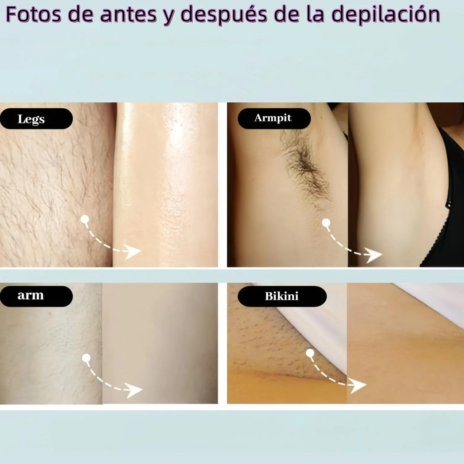 Lumina Lumisilk Depiladora Laser 2.0 Pro, IPL Tecnología, Detiene Crecimiento Vello, Depilación Facial Bikini Corporal