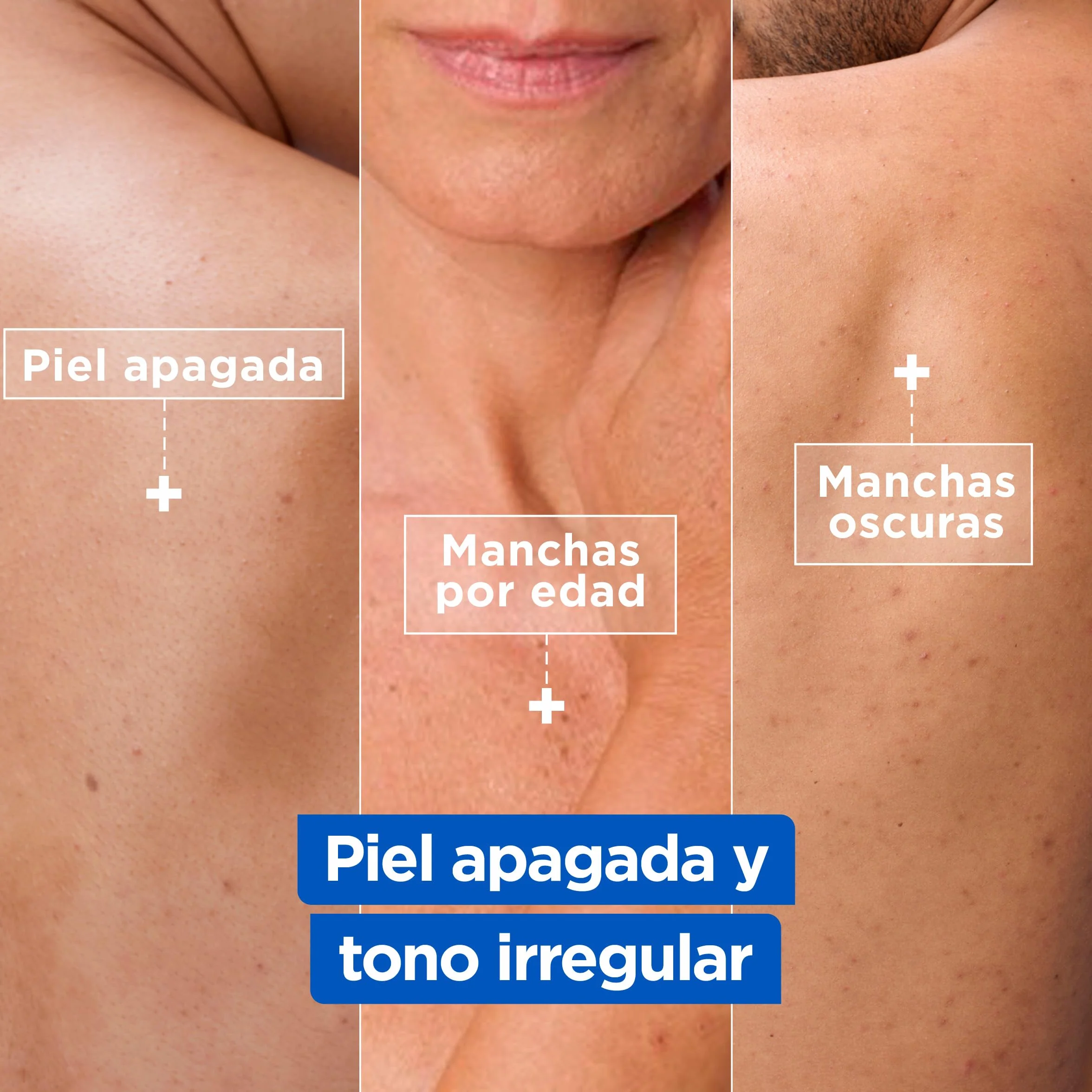 Mixa Crema Corporal Niacidamide Bright 9% Manteca de Karité Niacinamida Vitamina Cg 400 ml