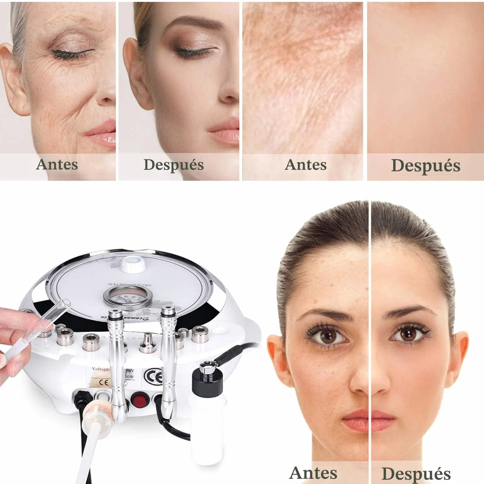 TwoWin 3 en 1 Microdermoabrasión Diamante Equipo Salón Belleza Facial 65-68 cmHg