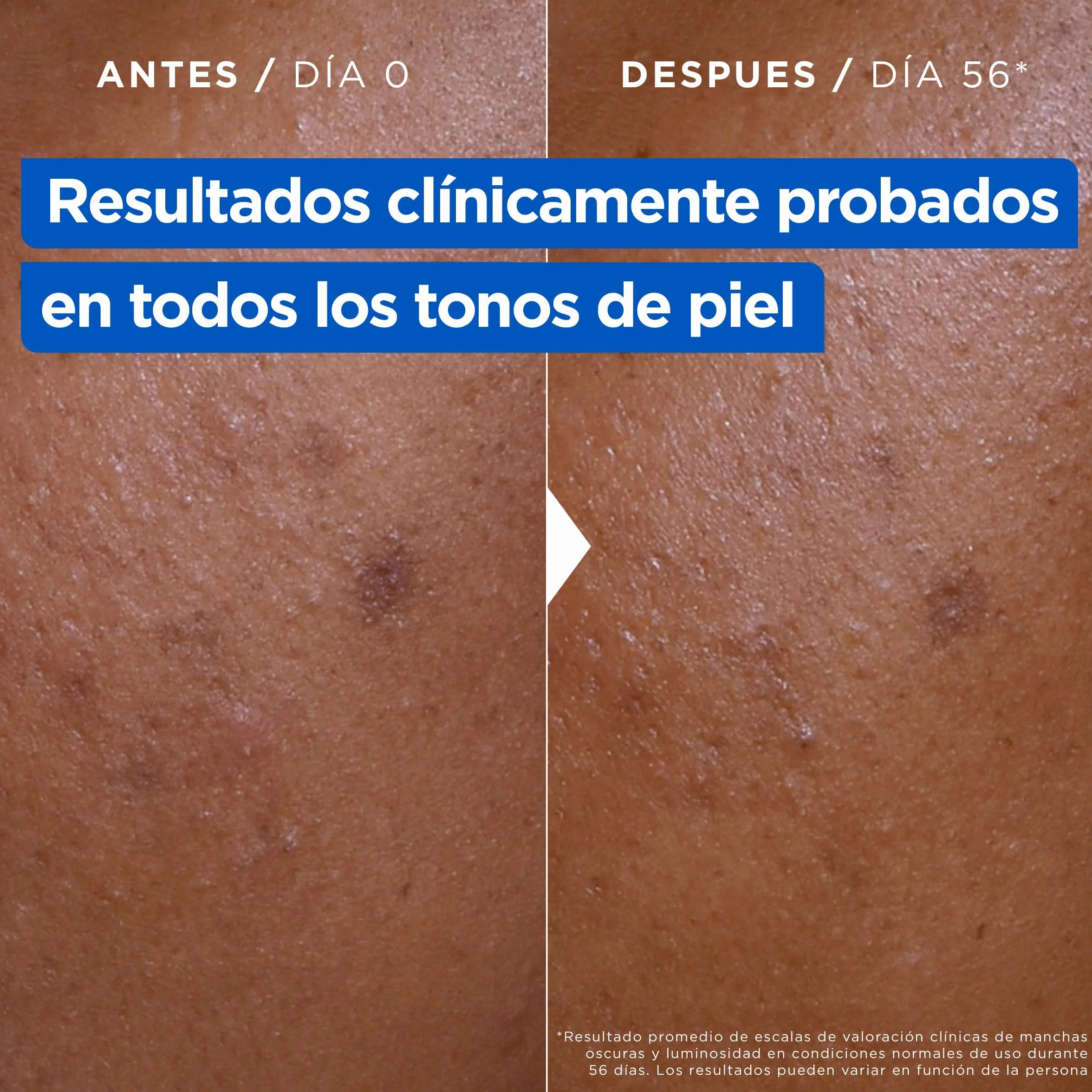 Mixa Crema Corporal Niacidamide Bright 9% Manteca de Karité Niacinamida Vitamina Cg 400 ml