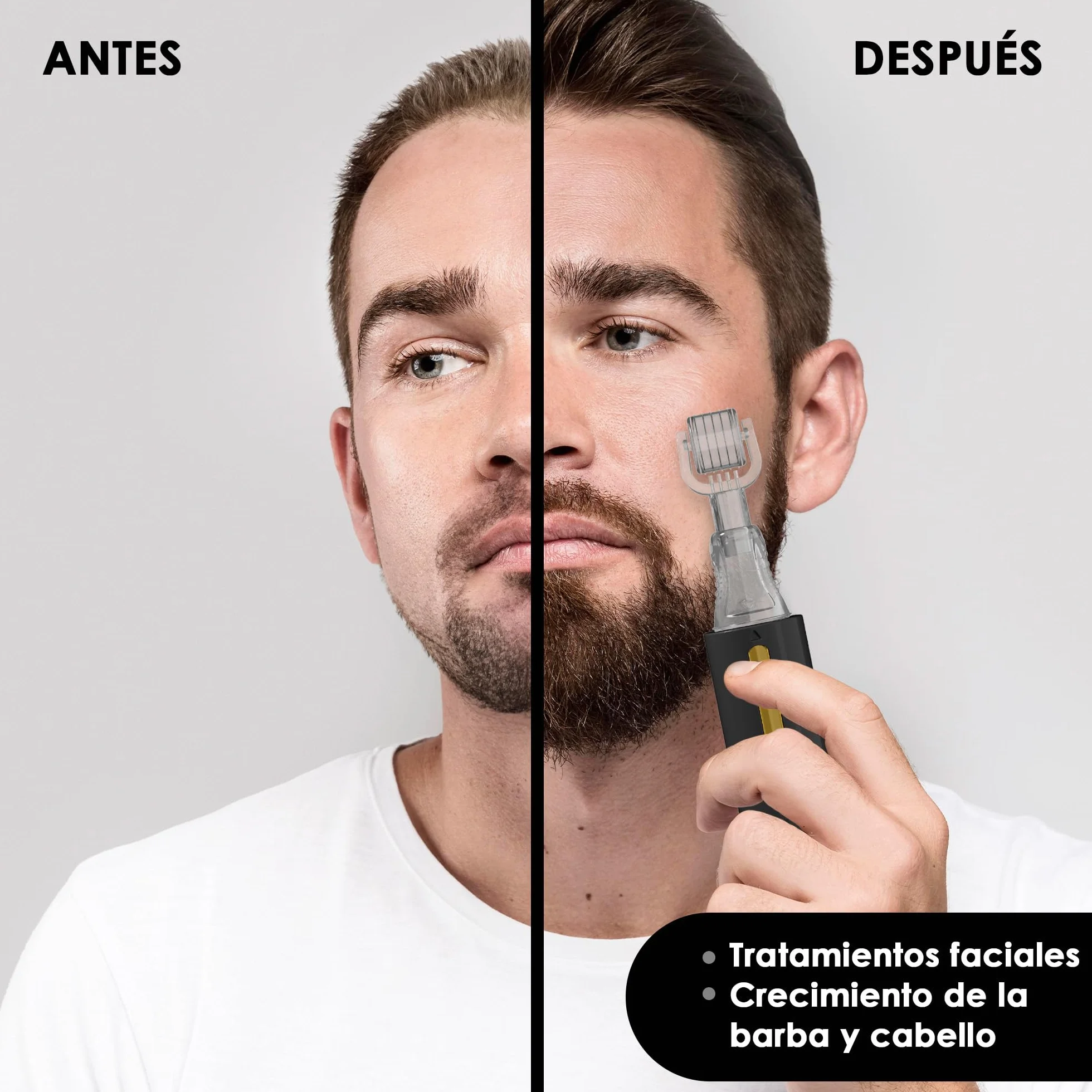 HAMINOS Derma Roller 0,5 mm con Depósito para Cabello, Barba, Piel, 105 Agujas de Titanio