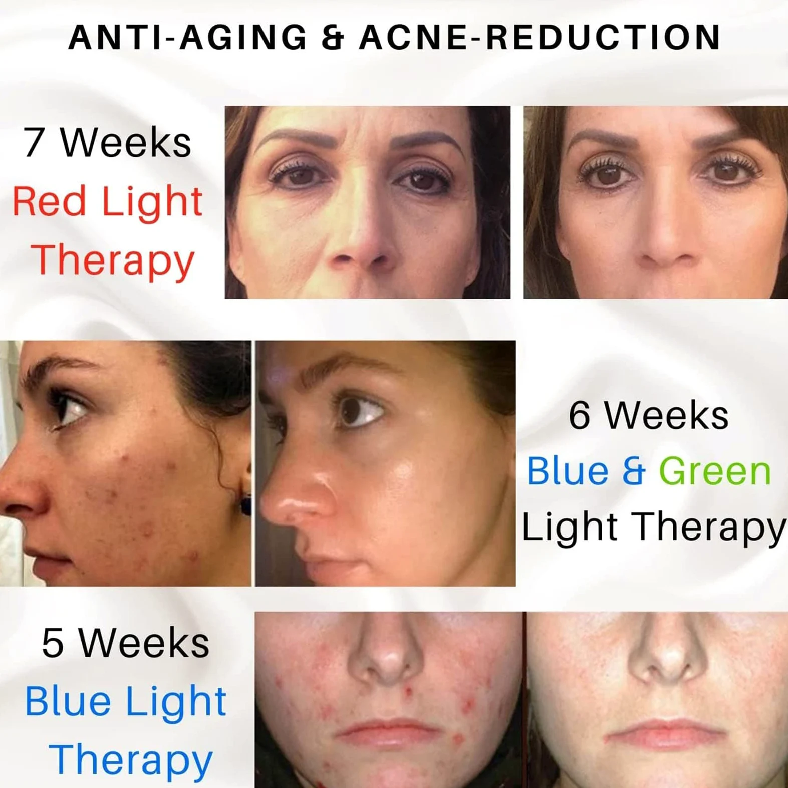 Máscara Facial LED de 7 Colores, LED Photon Máscara de Terapia de Luz Profesional con Cuello, Rejuvenecimiento de La Piel Tratamiento Facial Antiarrugas
