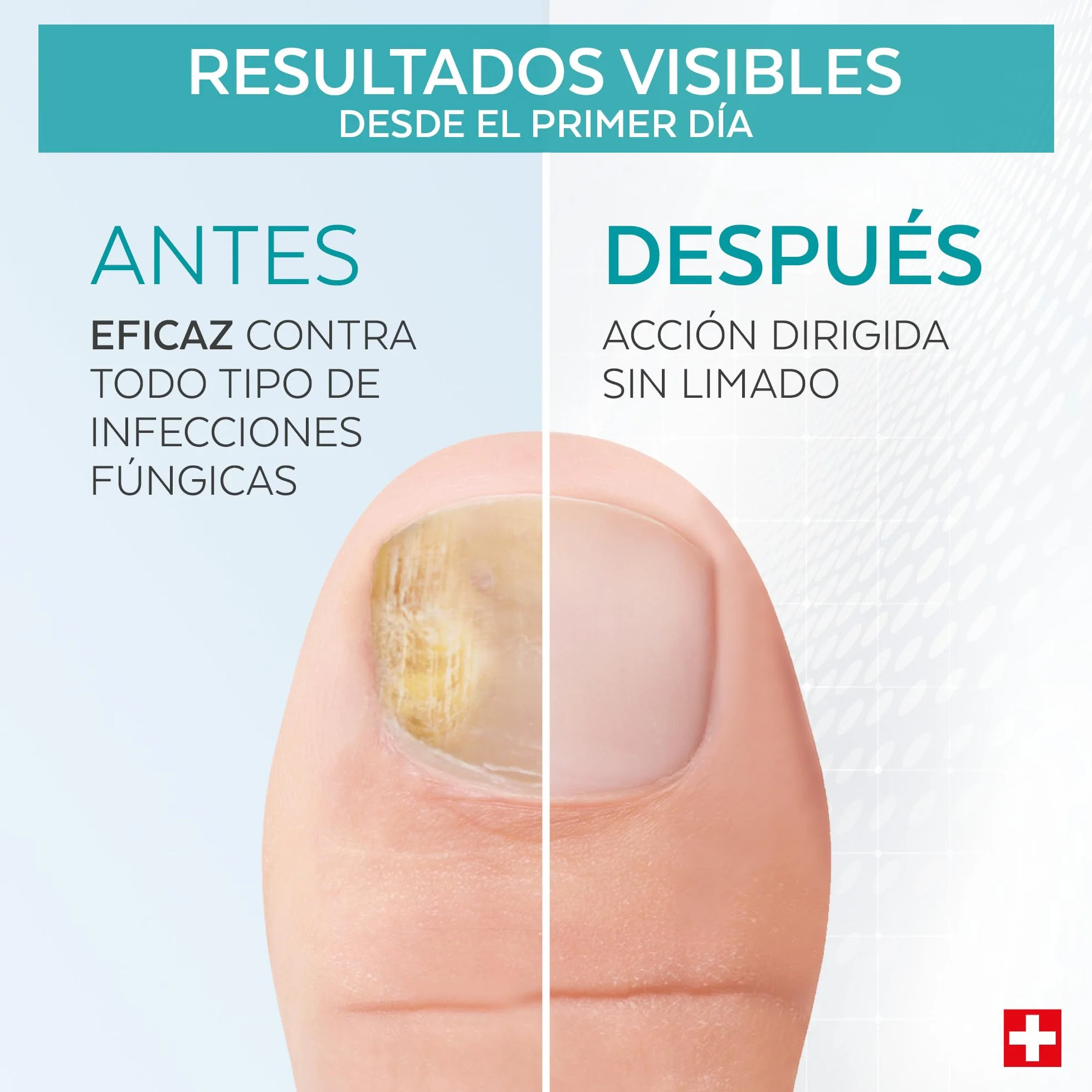 PODERM Tratamiento Hongos Uñas Pies Antihongos Reparador Purificante Revitalizante Cuidado Profesional Pie Mano Hecho en Suiza