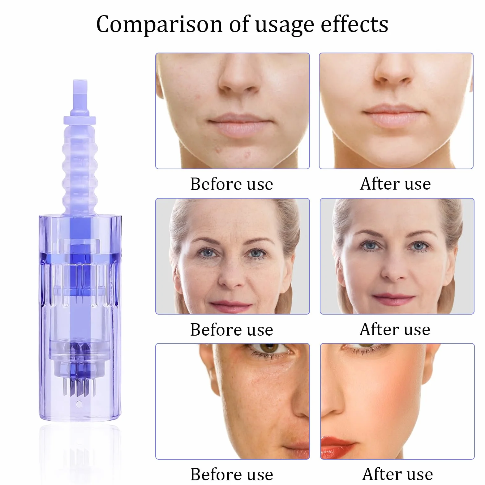 Agujas Dermapen 36 Puntas Microneedling Cartuchos Repuesto Antienvejecimiento Rejuvenecimiento Piel