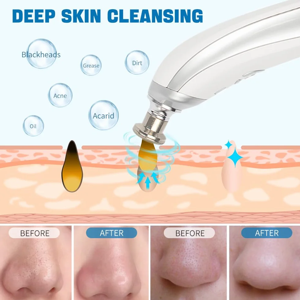 Maquina de Microdermoabrasión Facial con 9 Diamante Recargable USB Sin Cable