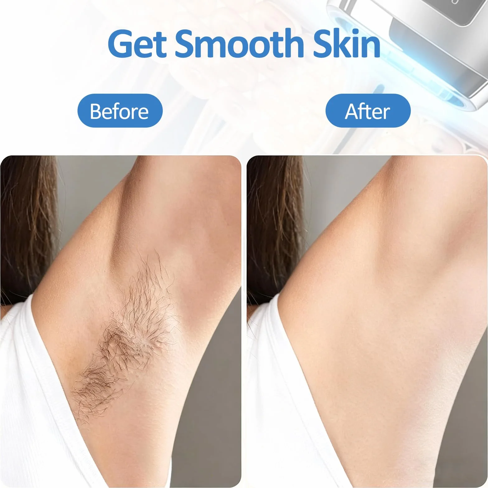 Depiladora Laser Luz Pulsada 530-1200 NM para Mujer y Hombre Cuerpo Rostro Bikini