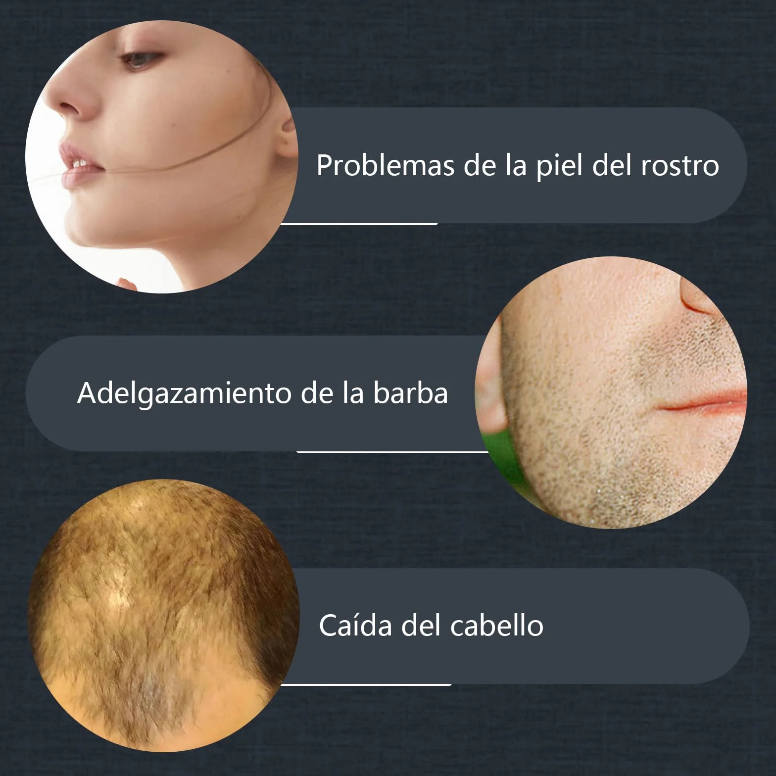 Derma Roller Cabello 0.5mm Microneedling para Crecimiento Barba y Cabello