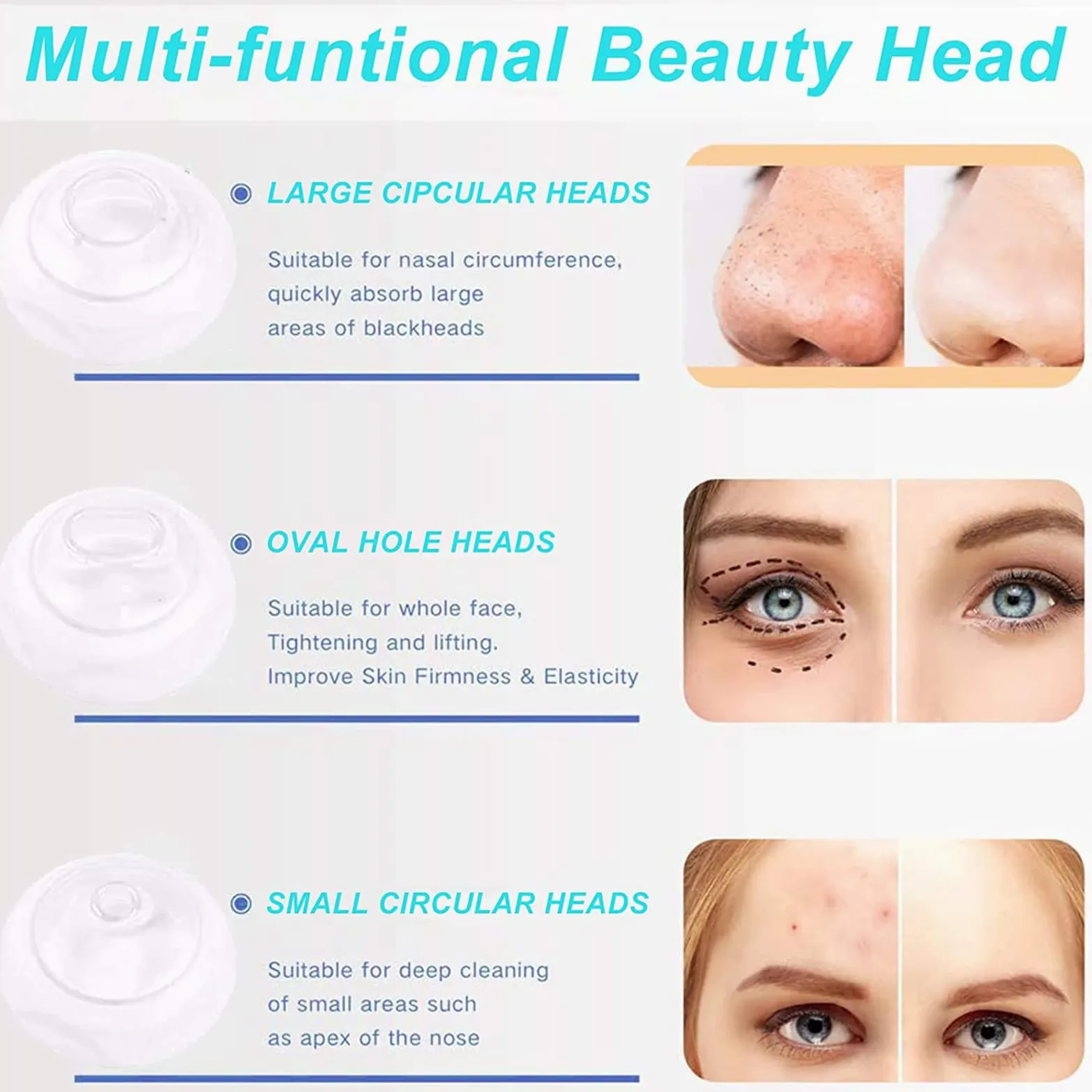 WolFum Limpiador facial de poros: extractor de espinillas de limpieza facial, herramienta de succión de puntos negros, aspiradora de poros para eliminar puntos negros, herramienta extractora de puntos