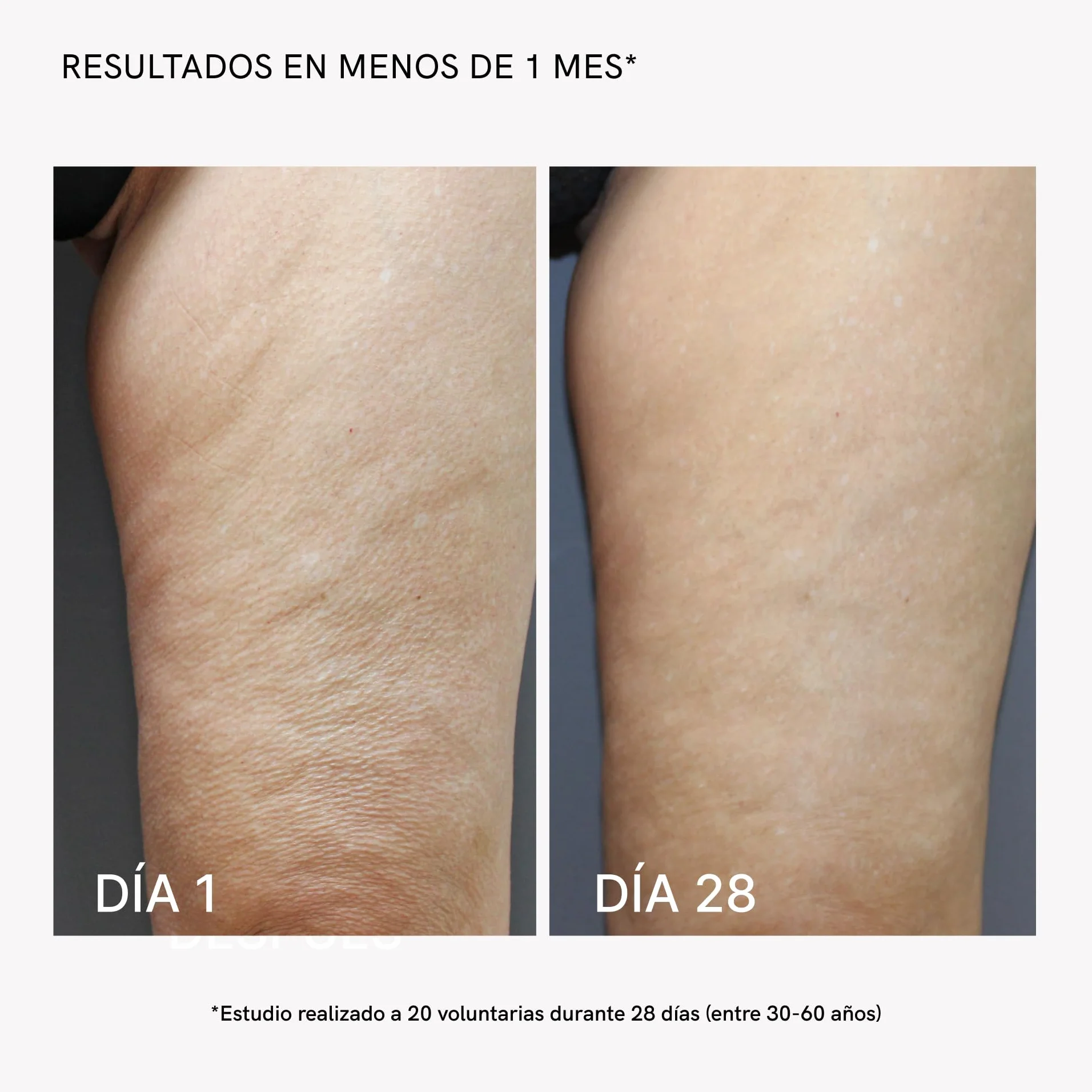 MASDERM Gel y Crema Corporal Radiofrecuencia Reafirmante Hidratante 1000 ml Profesional para Mujer