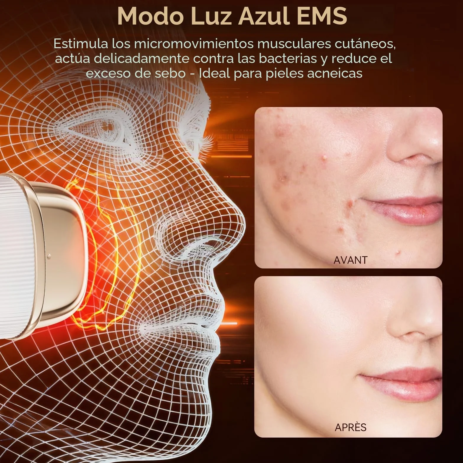 ANLAN Mini Radiofrecuencia Facial, 24K Oro RF Aparato Reafirmante y Antiarrugas, EMS Masajeador Facial Antienvejecimiento, 3 Modos, 3 Niveles, IPX6