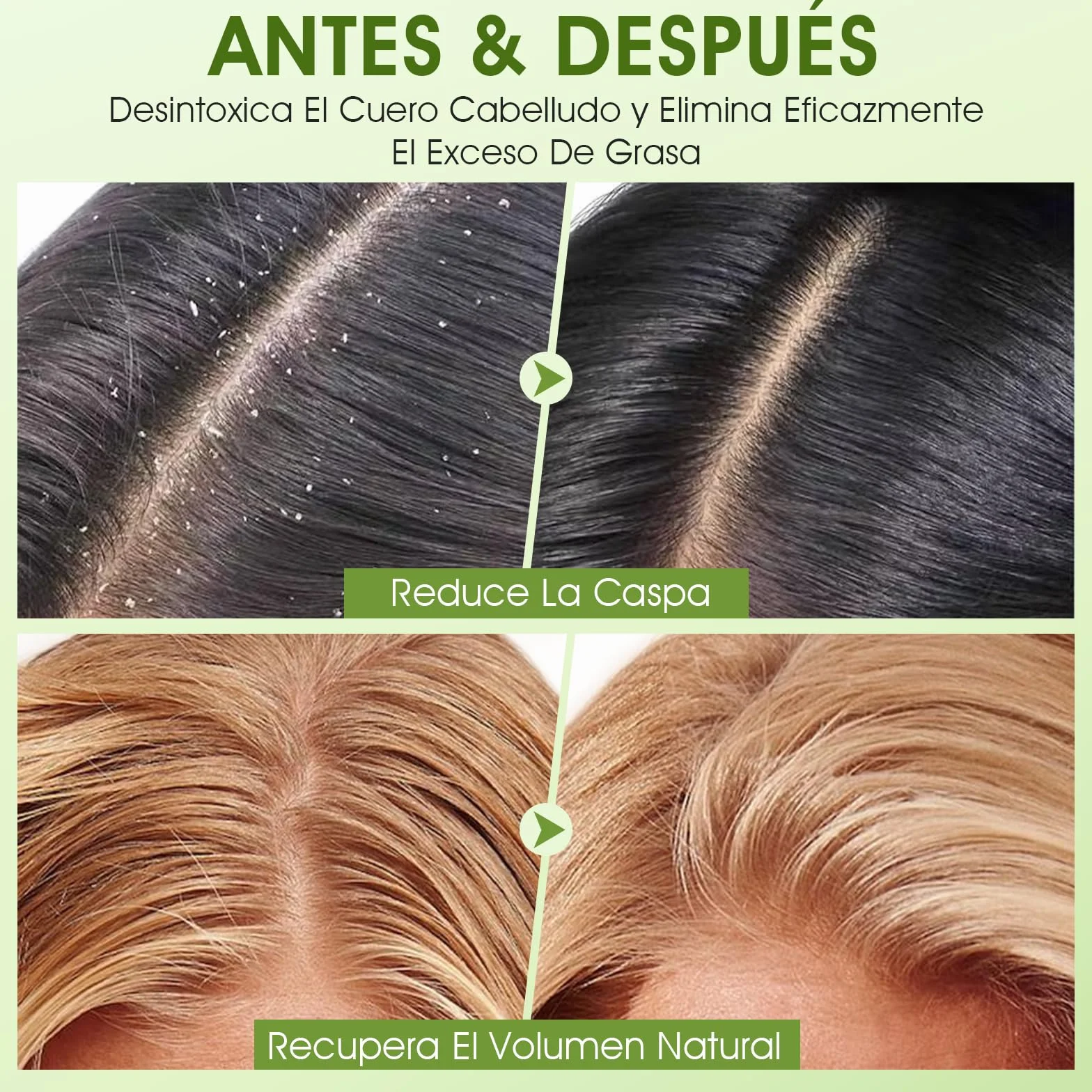 Exfoliante de cuero cabelludo AHA BHA 2 en 1 con masajeador de silicona