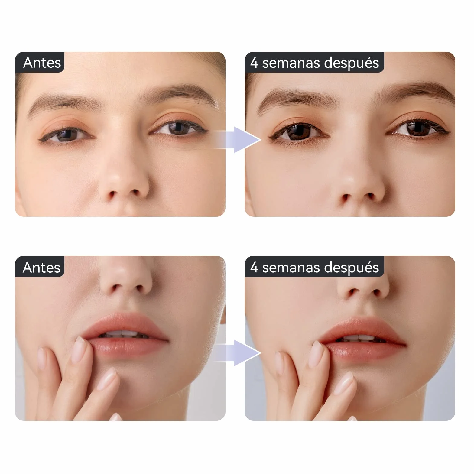 ANLAN Masajeador de Ojos, EMS Dispositivo de Ojos Antiarrugas y Antiedad, Luz Roja& Azu de LED Terapia, 40 ℃ Compresa Caliente, Mejora Ojeras, Bolsas, Hinchazón, Arrugas, Contorno de Ojos