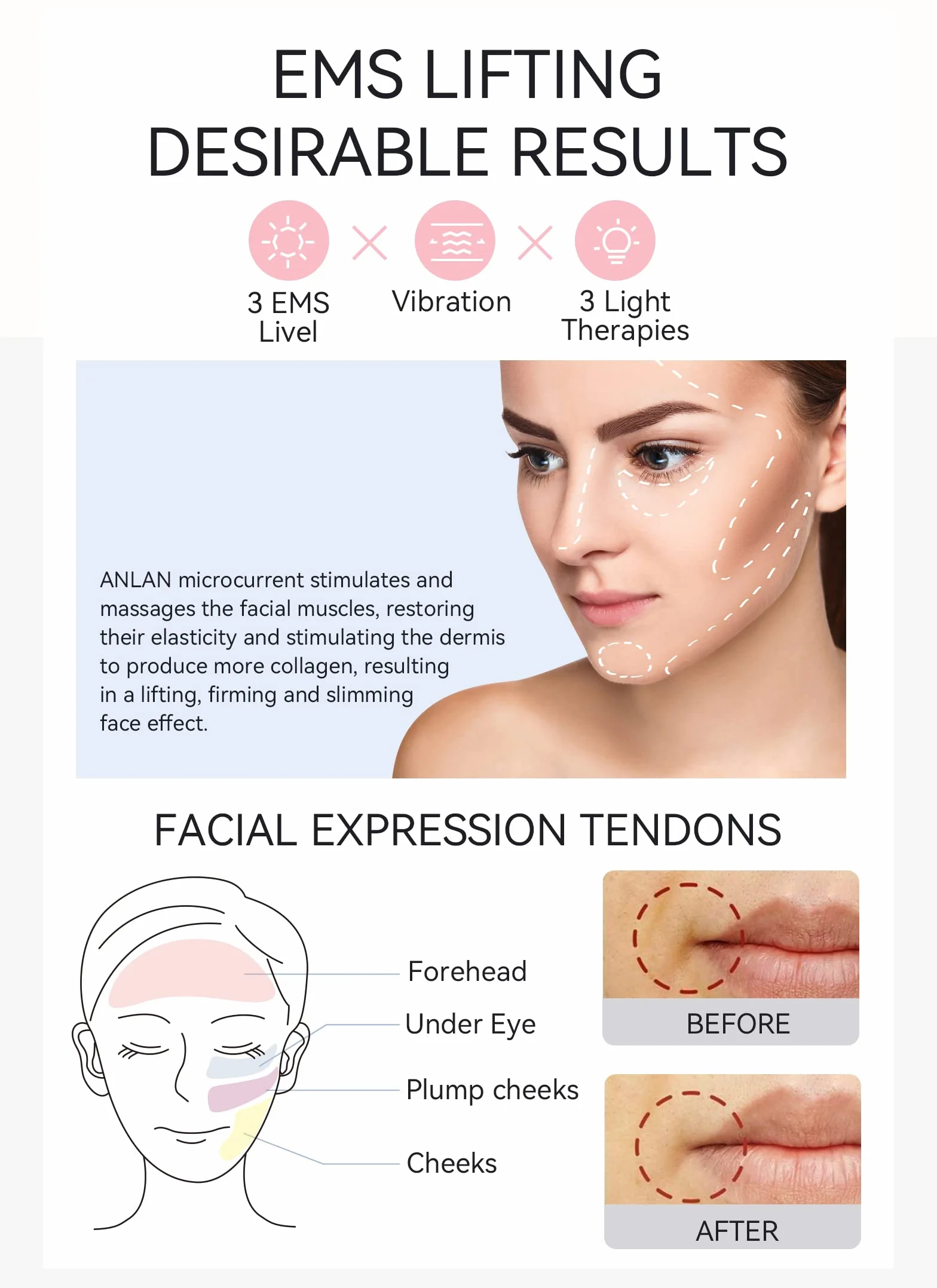 ANLAN Masajeador Facial para Antiarrugas y Reafirmante, 5EN1 Maquina Estetica Antienvejecimiento, Cuidado Facial, Antiflacidez Cara y Cuello, Limpieza profunda, con algodón