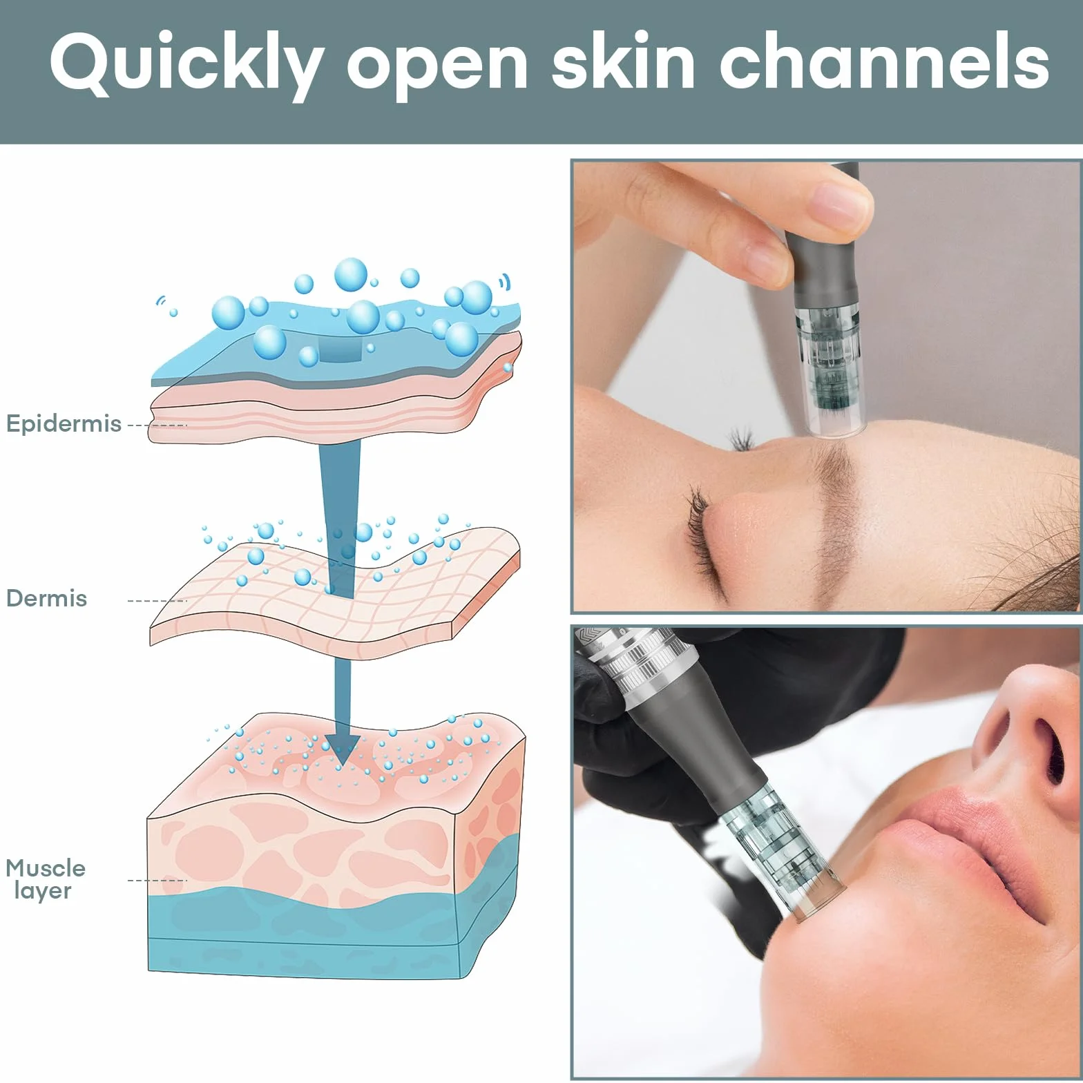 Agujas Dermapen M8 36 puntas Microneedling Cartuchos 3 ranura bayoneta para M8 M7S A6S 20 unidades