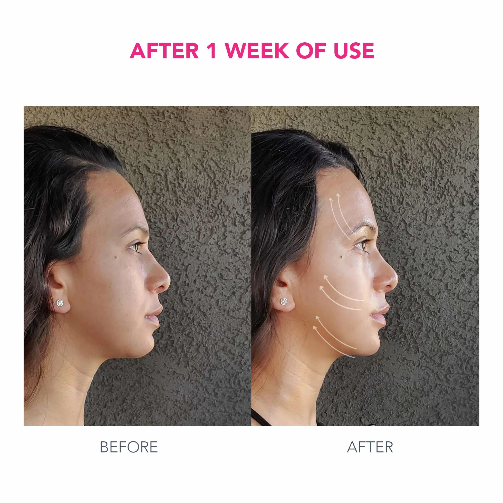 FOREO BEAR Reafirmante Dispositivo de Microcorrientes Facial + 2x Sérum 30 ml Ácido Hialurónico Masajeador Antiedad Fuchsia