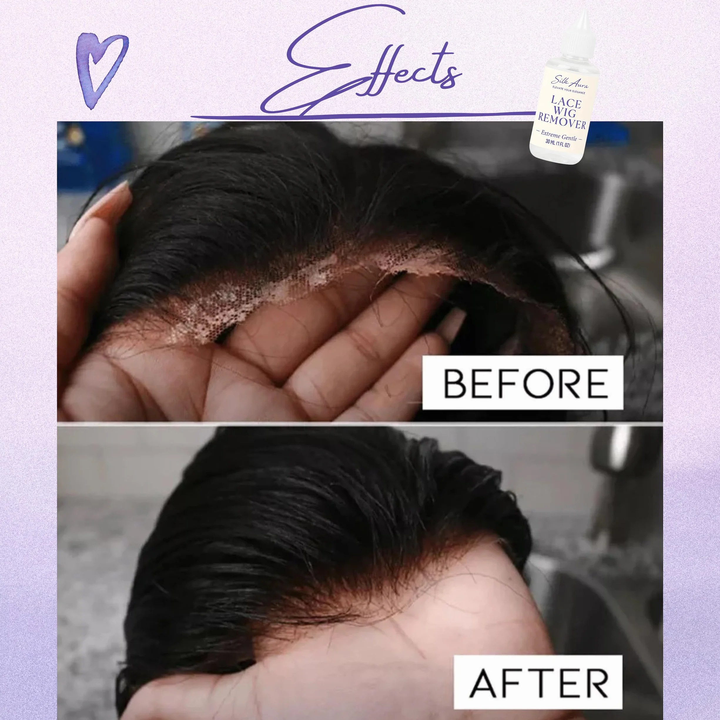 Removedor de pegamento para pelucas de encaje frontal, suave con la piel, 30 ml