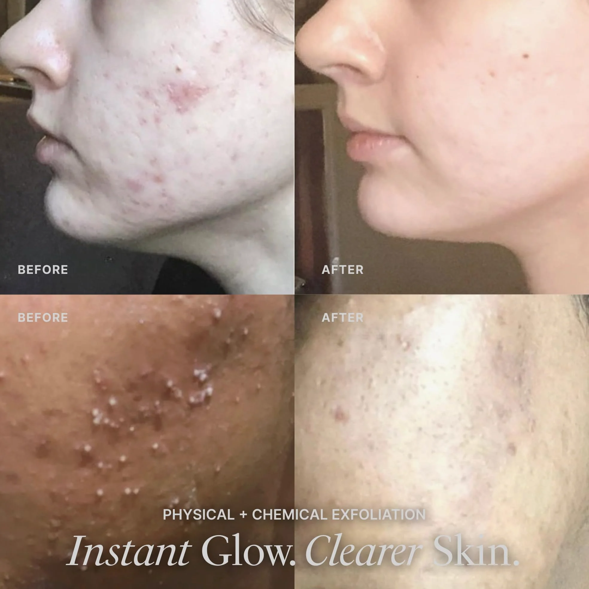 Vasanti Cosmetics Brighten Up. Enzymatic Face Rejuvenator with Microderm Exfoliating Crystals – Treats Dull, Uneven Skintone