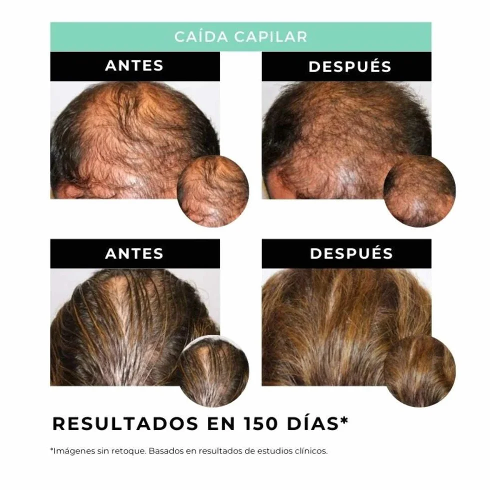 Strength - Sérum Fortalecedor del Cabello