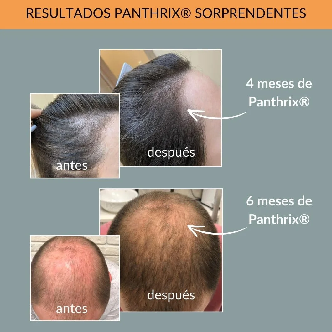 Panthrix Activador Crecimiento Cabello Spray 100 ml Tónico Alta Dosis Hombres Mujeres