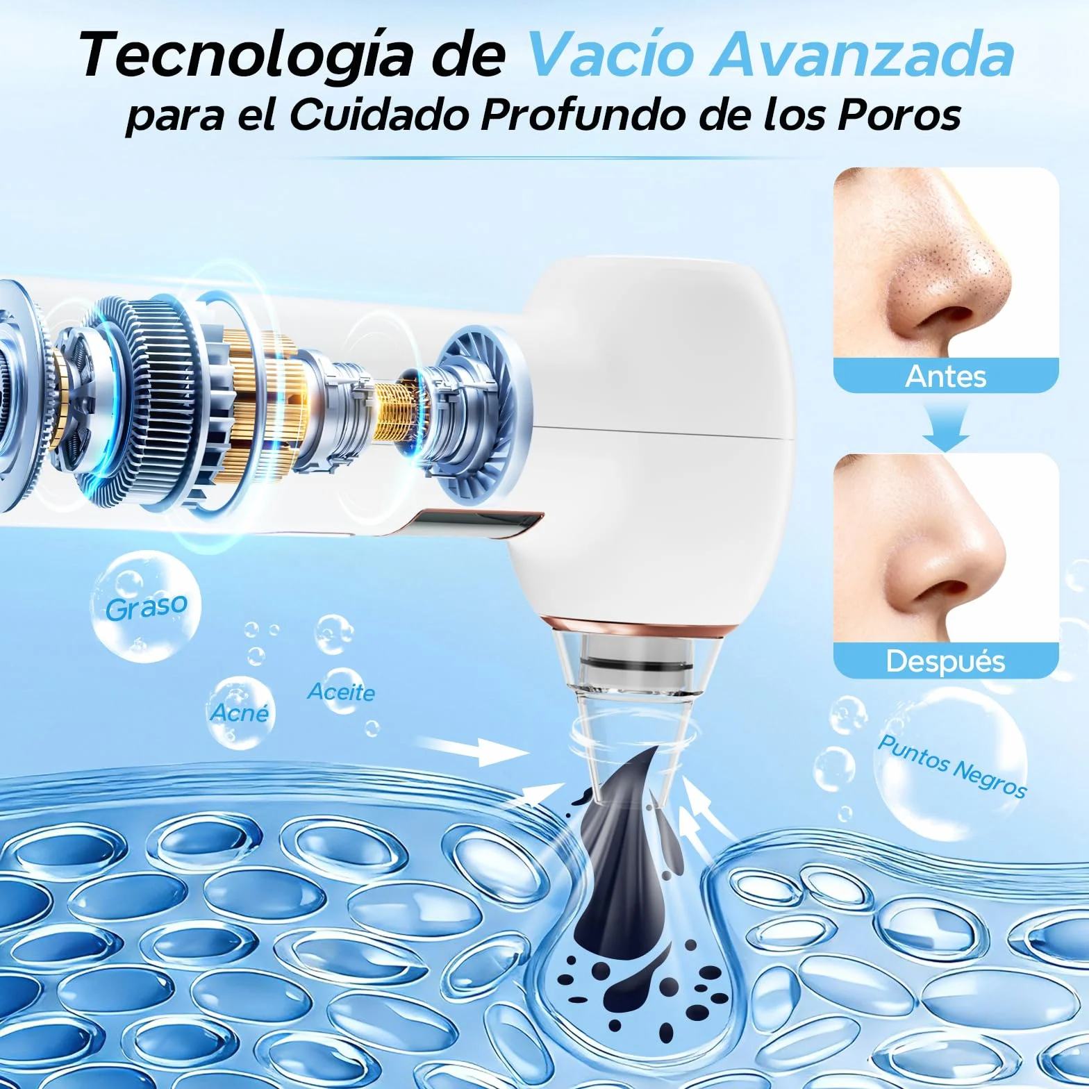 Succionador de puntos negros 5 Boquillas 3 Modos Limpieza Facial Nasal Kit Eliminar Comedones Acné Graso