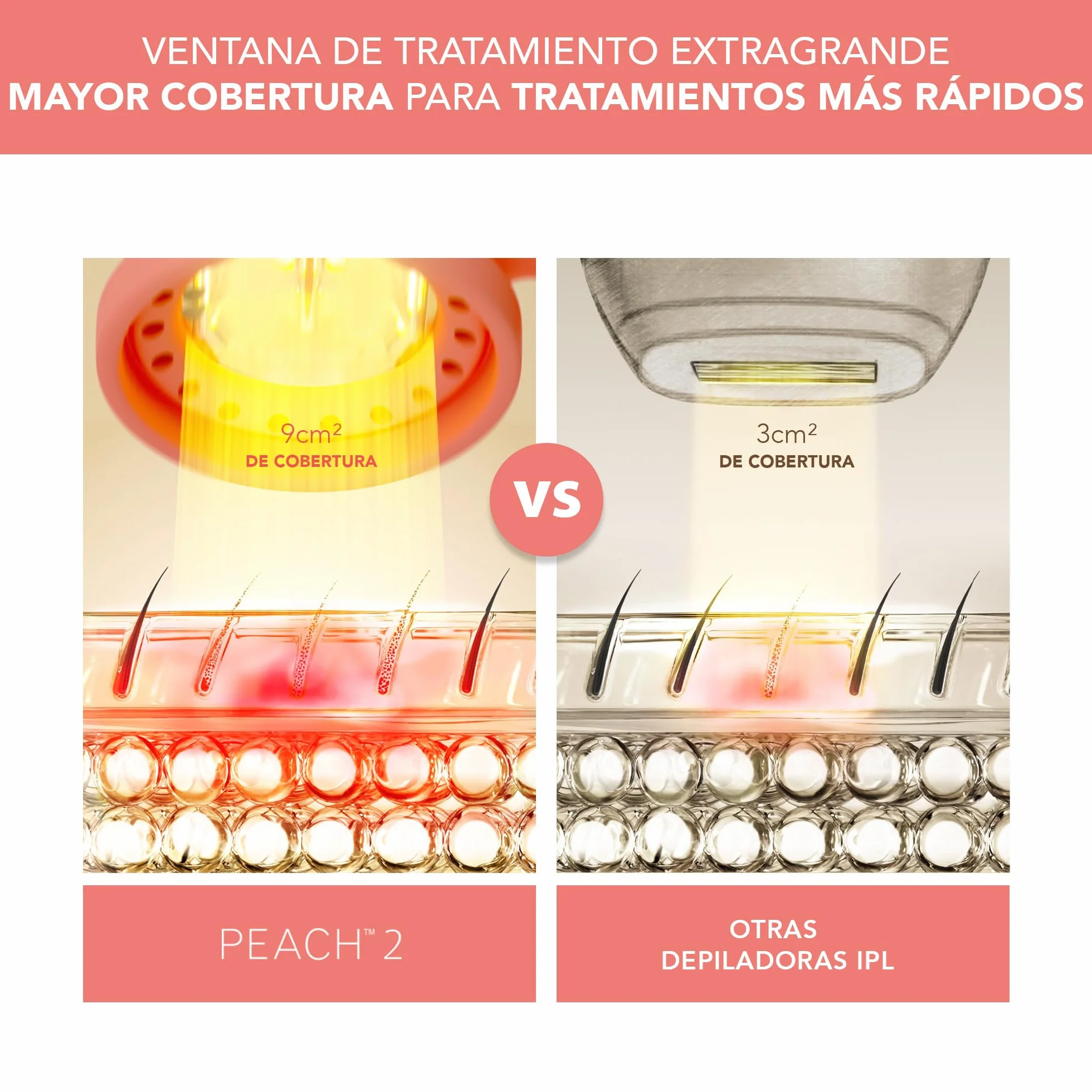 FOREO PEACH 2 Depiladora láser IPL Depilación duradera luz pulsada cuerpo rostro enfriamiento piel escudo silicona