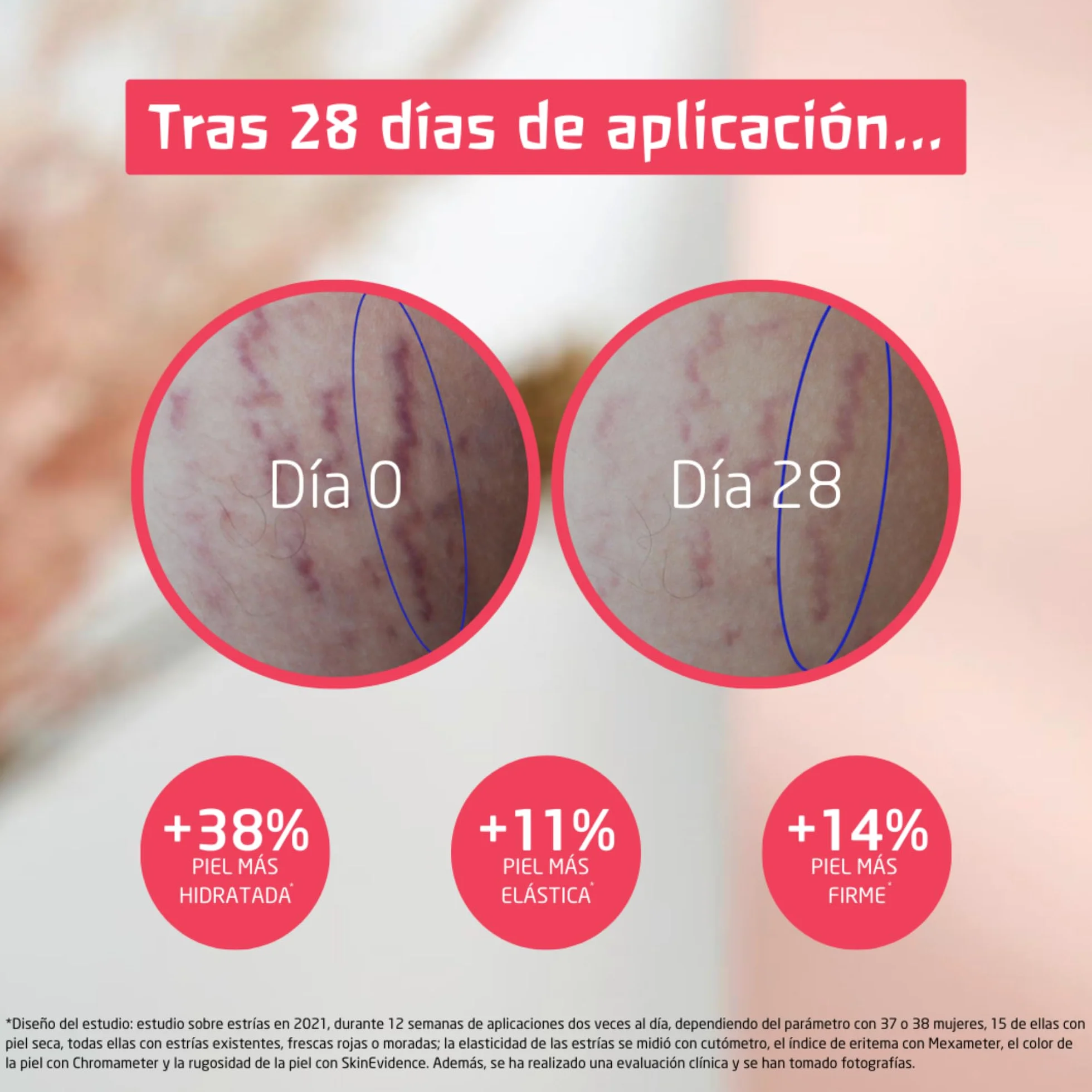 Weleda Bálsamo de Masaje Antiestrías Embarazo Manteca de Karité Jojoba 150 ml