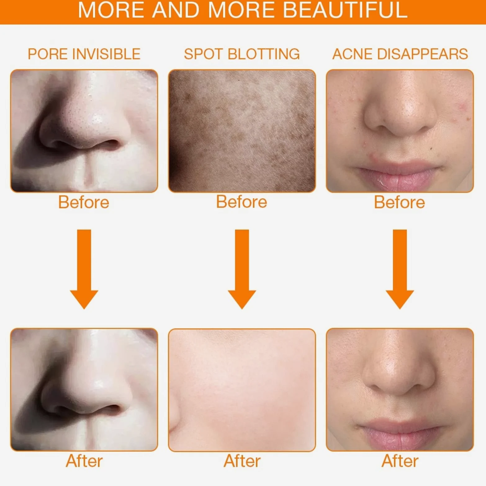 7 Colores Terapia de luz LED Mascarilla Cuello Rejuvenecimiento de la Piel Fototerapia Máscara de Belleza Anti Acné Apriete la Piel Aclare la máquina Salón de Belleza Cuidado de la Piel,Oro