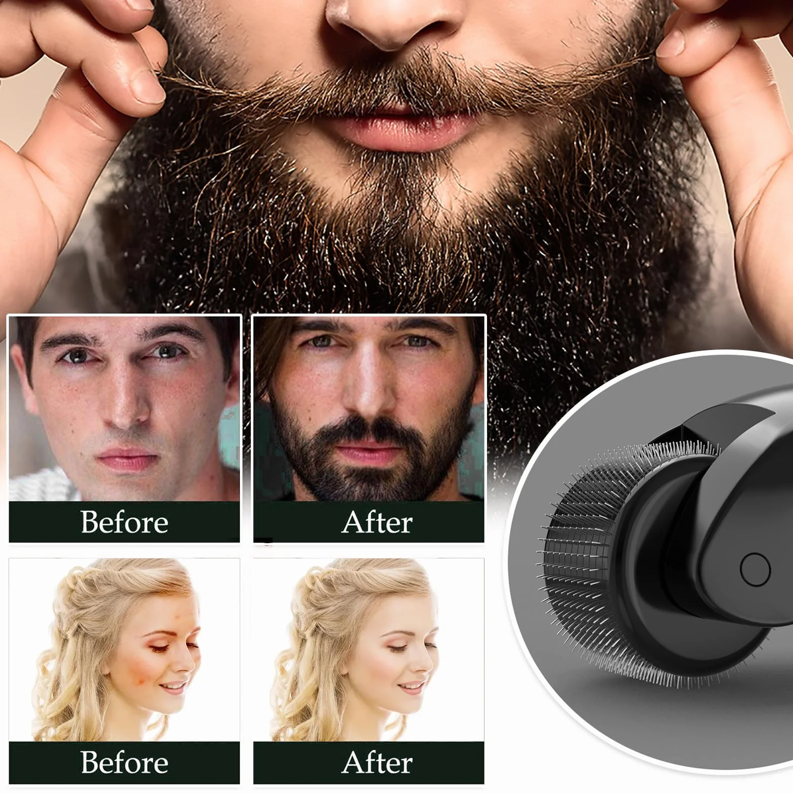 Dermaroller Microagujas 1 mm Negro Mate para Barba y Cabello