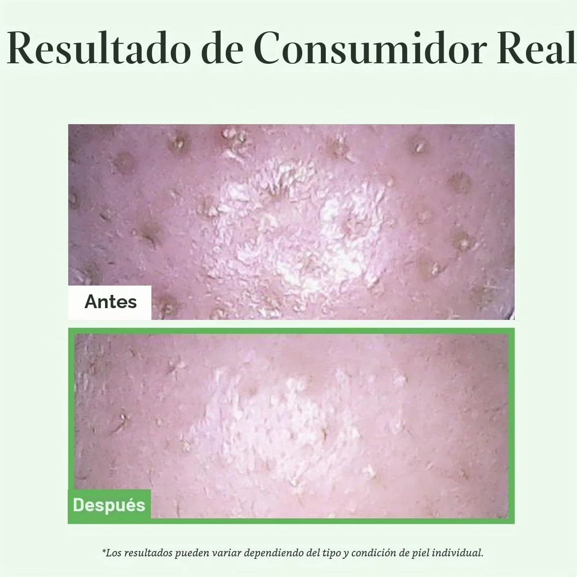 Arencia Pore Melt Mochi Aceite Limpiador No Comedogénico 200 ml