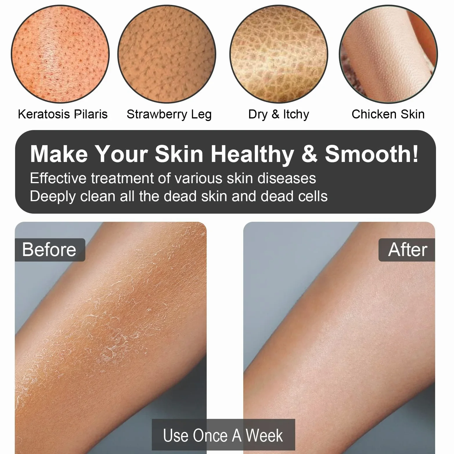 Guantes exfoliantes coreanos 2 piezas, exfoliante corporal para baño ducha exfoliante manopla exfoliación, exfoliante corporal, guante removedor de piel muerta para mujeres hombres