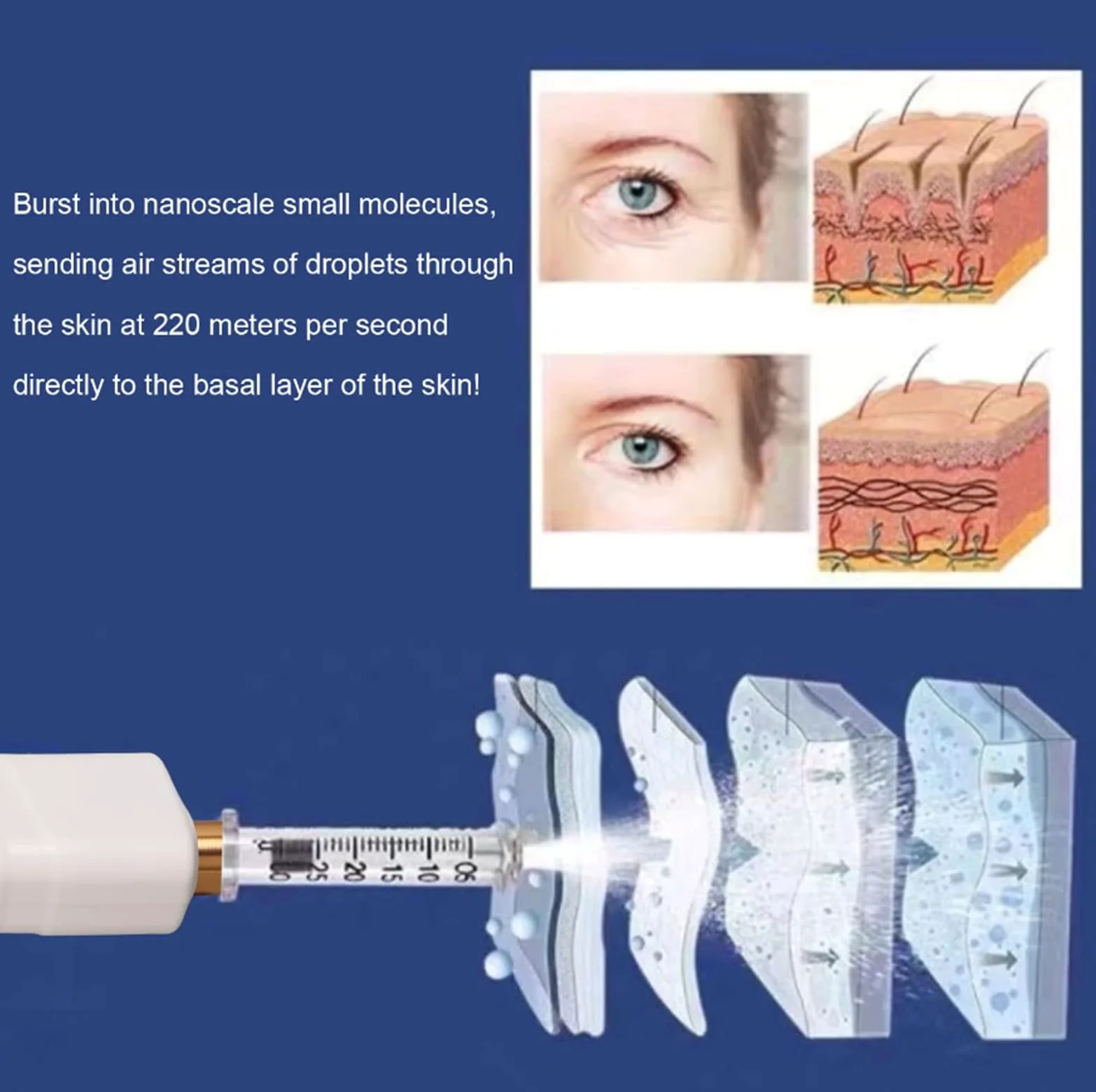 Mini Pluma De Inyección Hialurónica Dispositivo De Belleza De Inyección De Suero Facial Para Eliminación De Arrugas Para Mujeres Para El Cuidado De La Piel