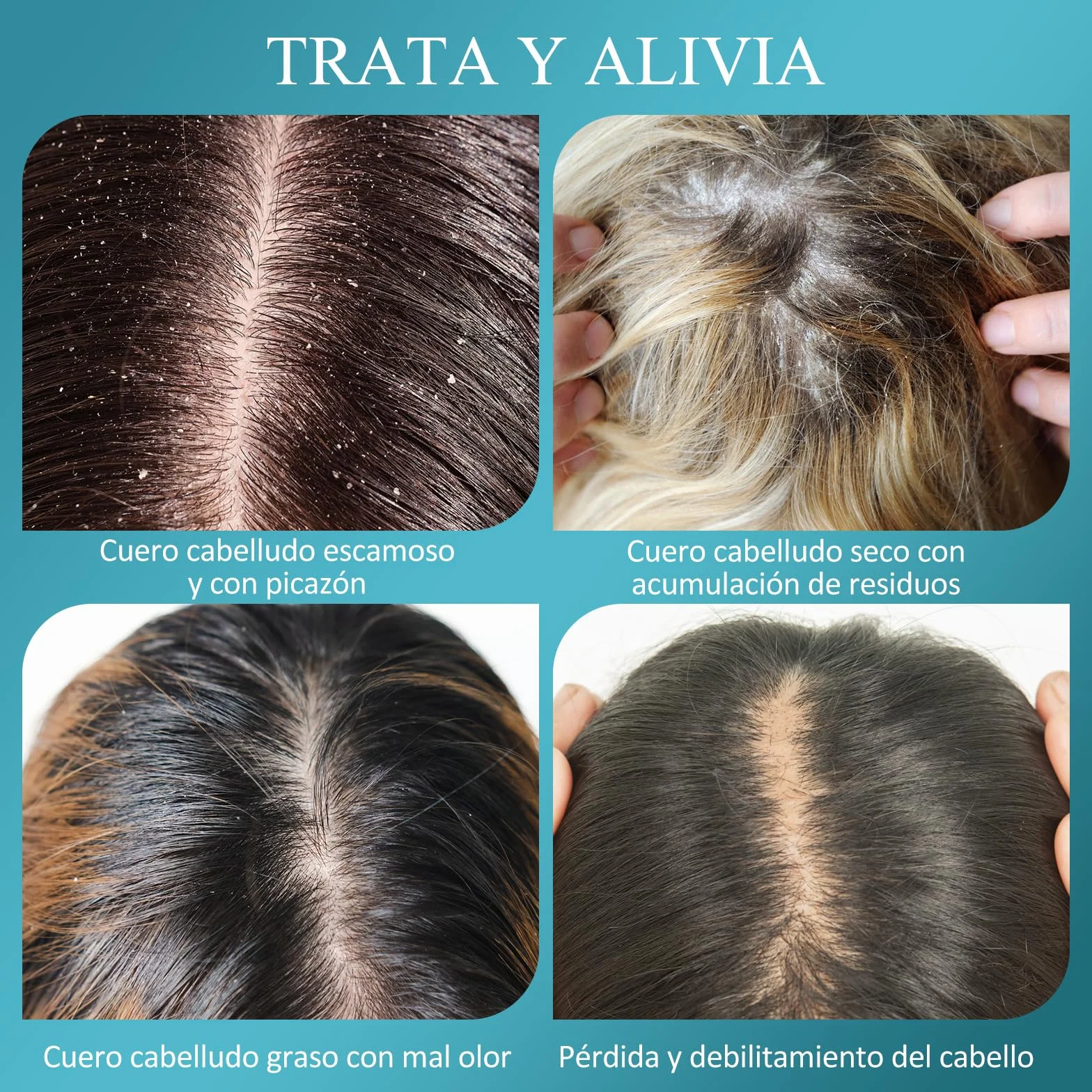 Exfoliante para el Cuero Cabelludo con Biotina y Ácido Salicílico para Crecimiento del Cabello, Cabello Graso y Caspa