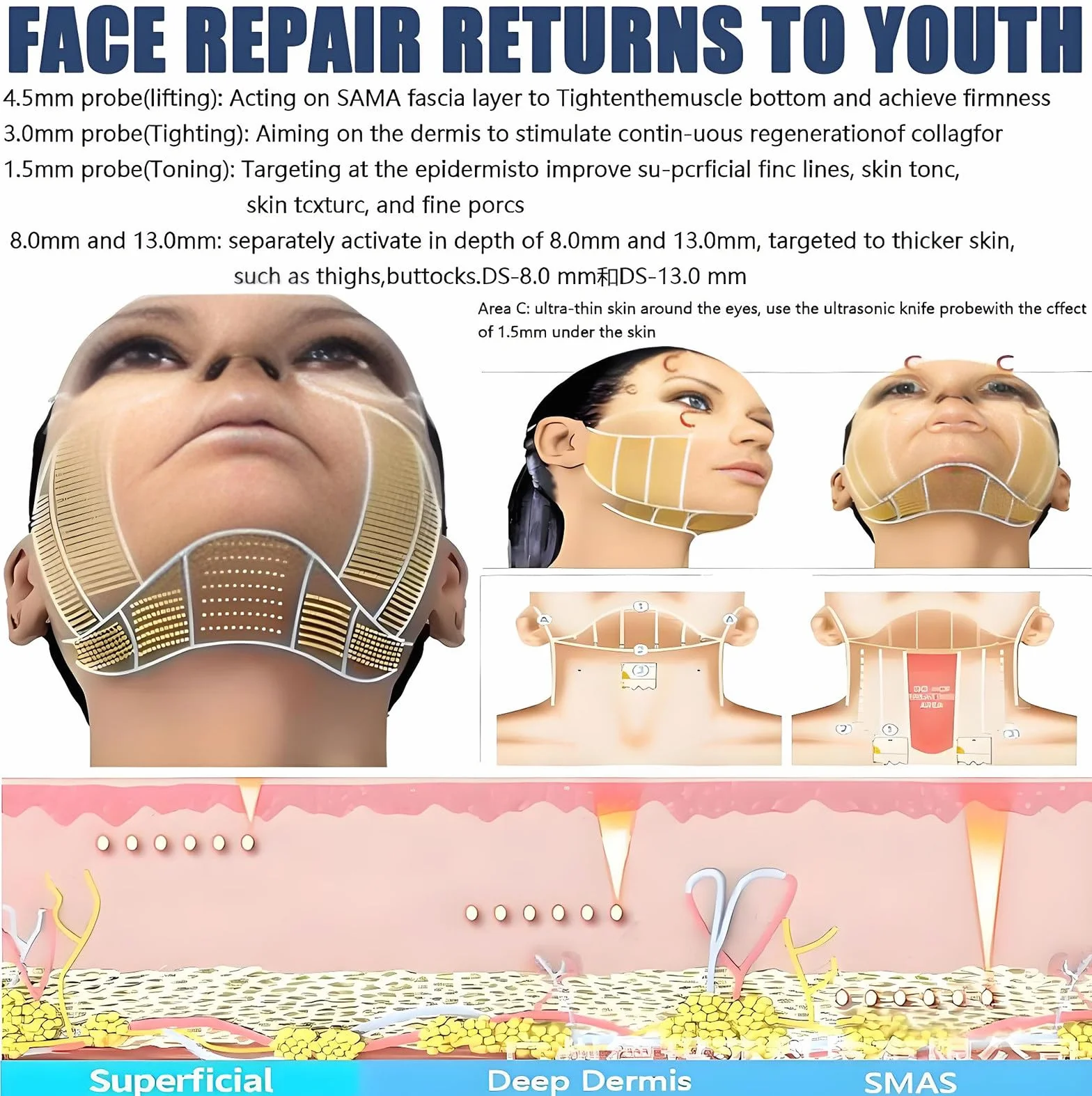 Profesional Dispositivo Hifu 7d 5 Profundidades Ajustables (1,5-13 Mm) Para Lifting Facial Y Corporal Antienvejecimiento