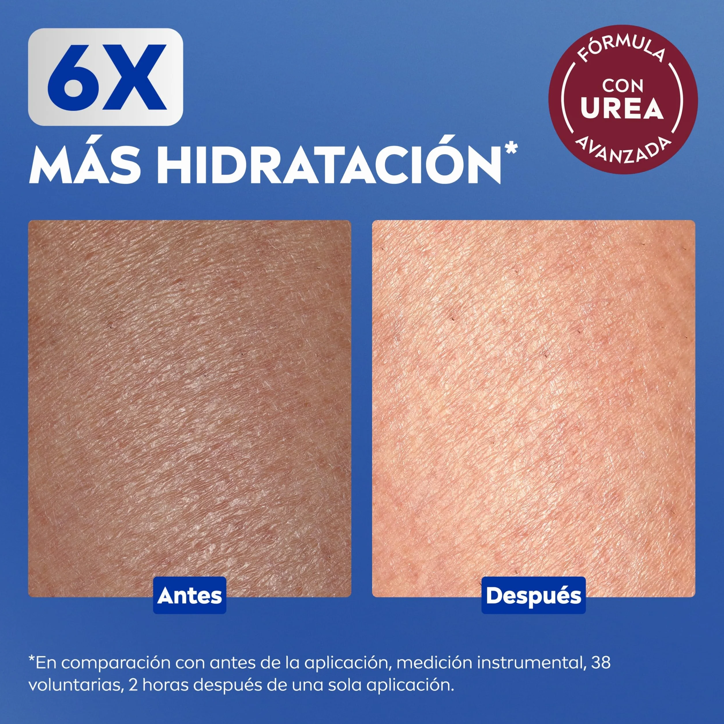 NIVEA Repara & Cuida Crema hidratante corporal 400 ml con glicerina y urea, 72 h hidratación para piel extra seca