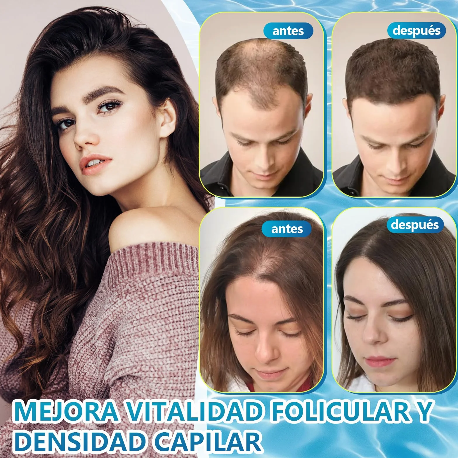 Suero De Crecimiento Del Cabello, Hair Growth Serum para Crece Pelo Rapido, Anticaida Pelo 60ml