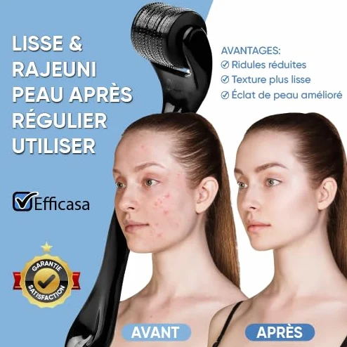 Dermaroller 0.5 mm para Crecimiento del Cabello y Barba – Microneedling Estimulante Folículo Capilar Uso Facial Hombre Mujer