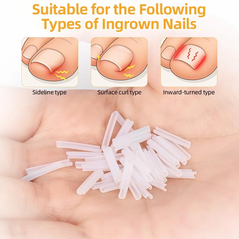 Beugo Juego de Uñas Encarnadas 168 PCS, 7 en 1 Kit de Pedicura en Acero Inoxidable con Cortaúñas