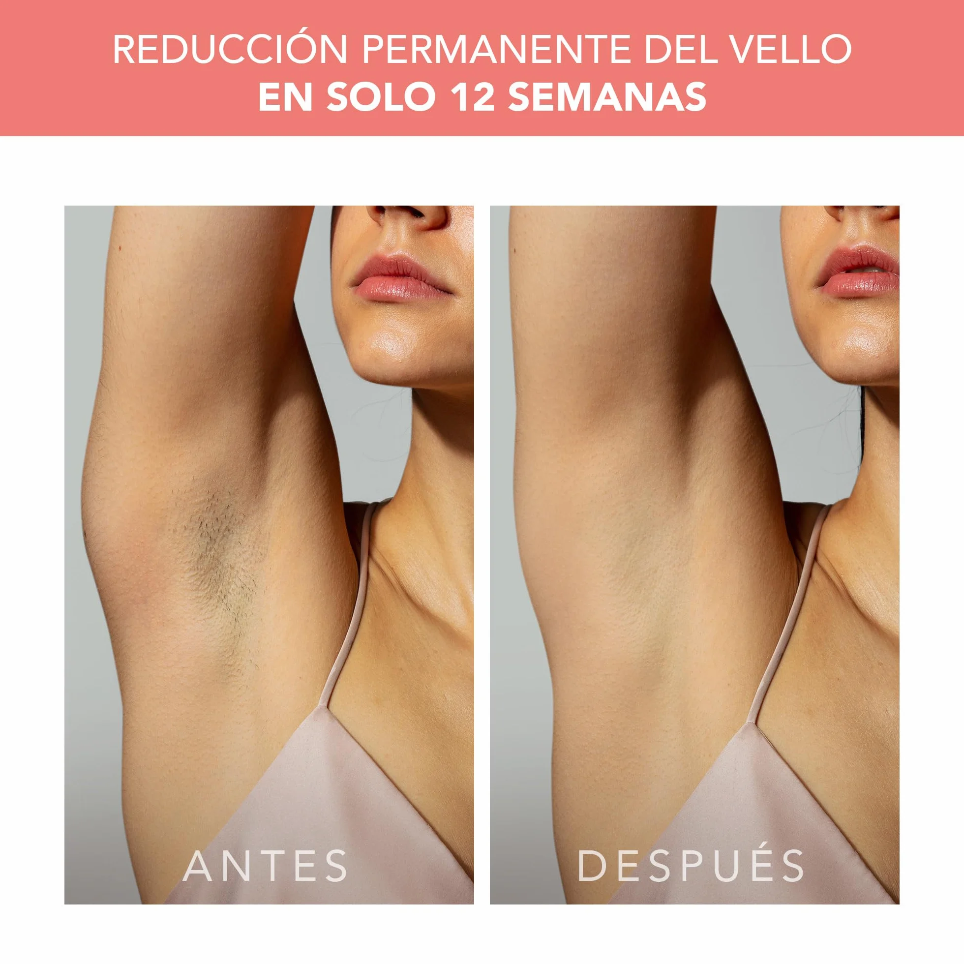 FOREO PEACH 2 Depiladora láser IPL Depilación duradera luz pulsada cuerpo rostro enfriamiento piel escudo silicona