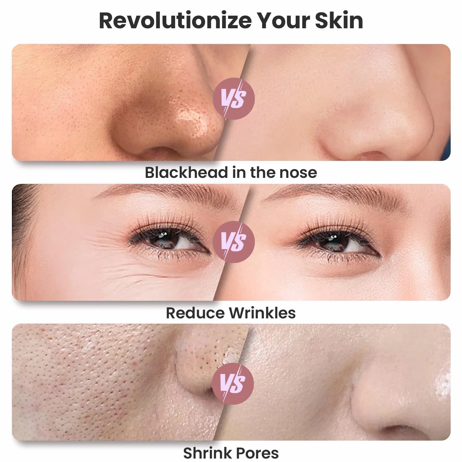UNOISETION Máquina de microdermoabrasión de diamante, máquina facial portátil para exfoliación, removedor de puntos negros, aspiradora de poros para uso doméstico