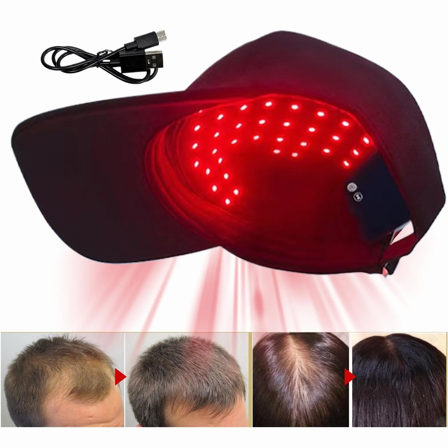 Gorro de Luz LED 450nm/660nm para Regeneración del Cabello y Crecimiento Capilar