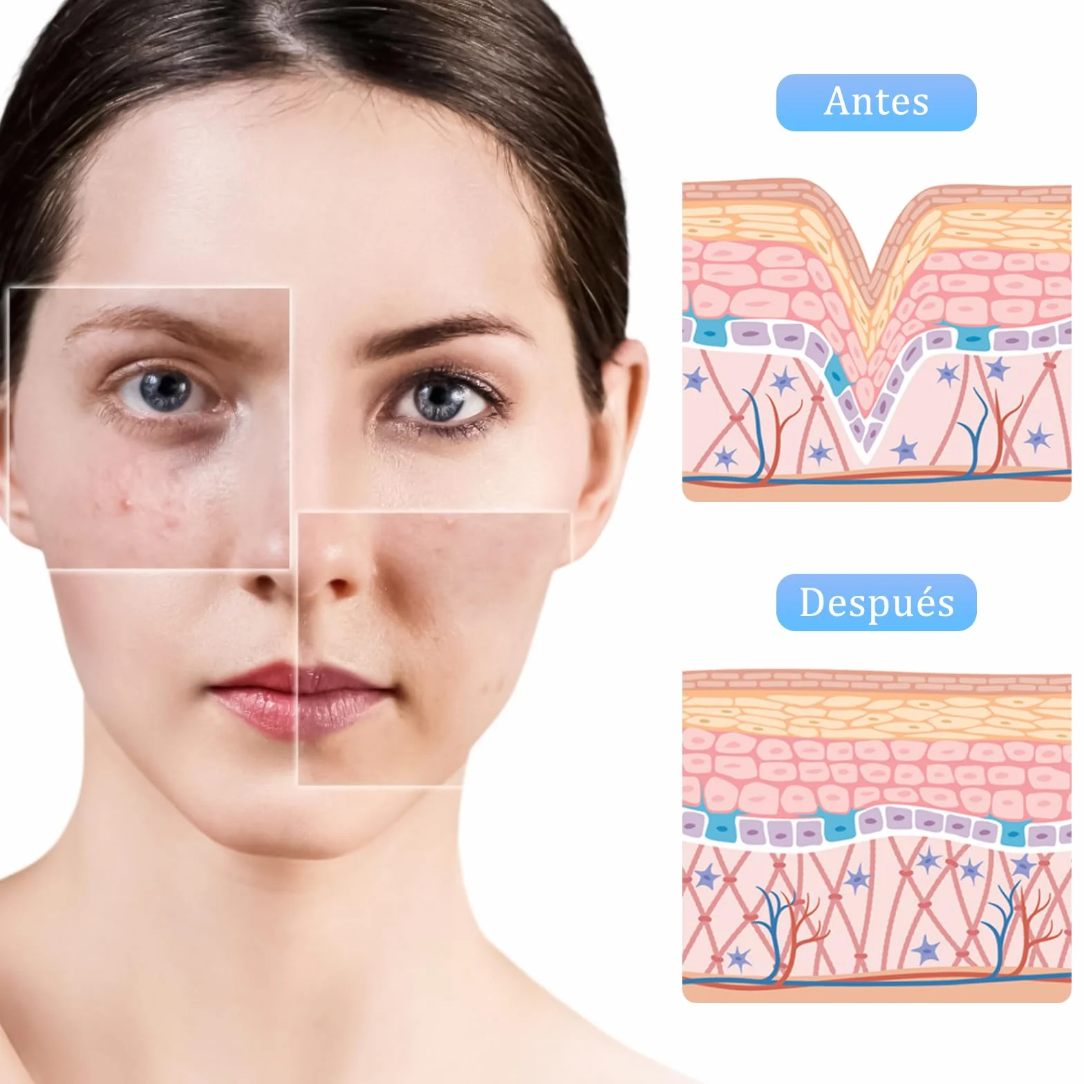 Dr.Pen M8S, microneedling pen con 6 x Cartuchos(3 x 12 Pin+3 x 36Pin), dermapen facial profesional, Inalámbrico y 6 Niveles de Velocidad, 0-2,5mm Profundidad ajustable, Plata