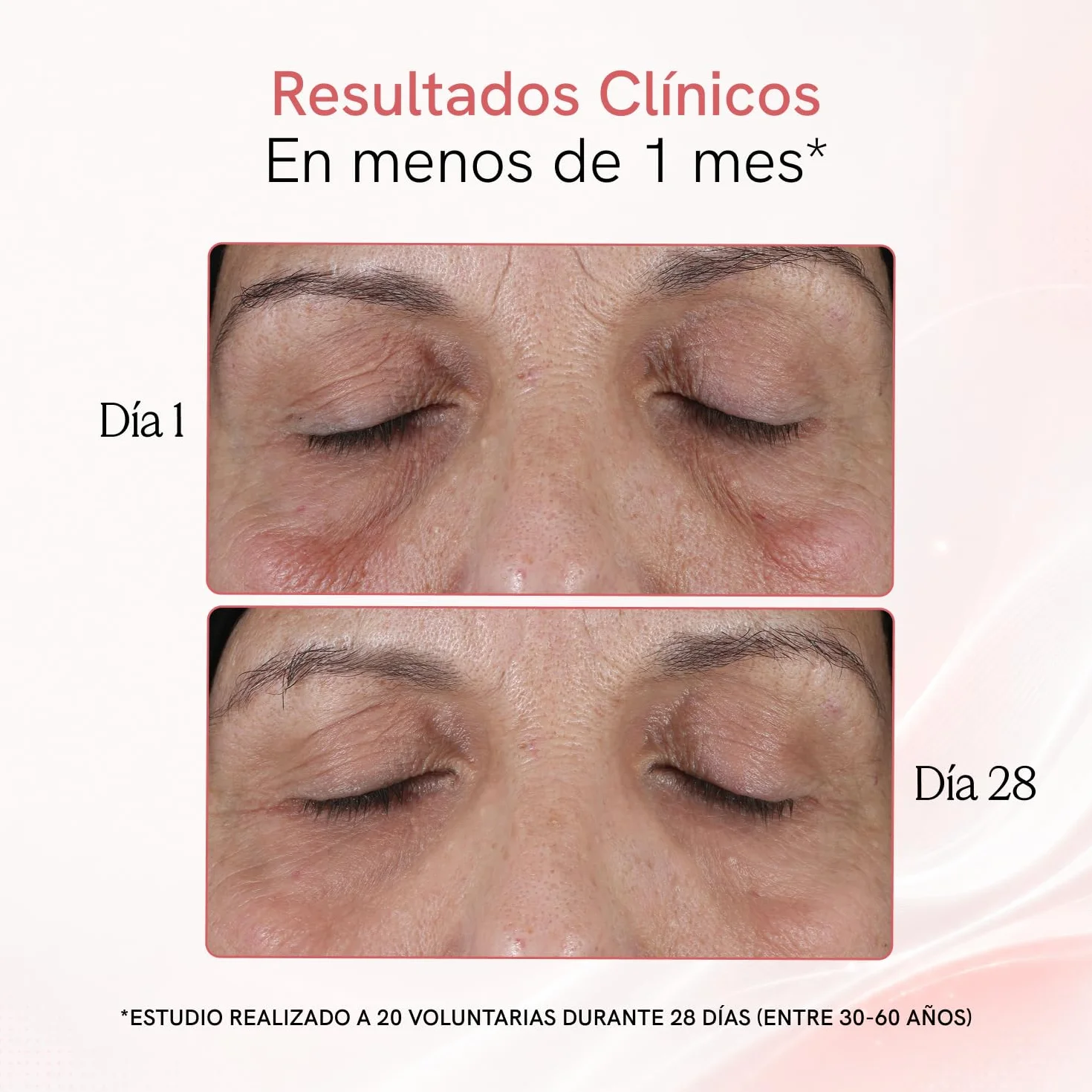 MASDERM Masajeador Facial Eléctrico 7 en 1, Radiofrecuencia y Luz LED, Tratamiento Antiedad Reafirmante